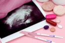 Egg Freezing Fertility Clinics